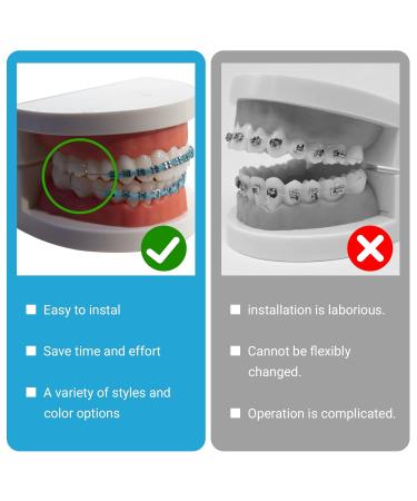 4 Pair of Temporary Tooth Decoration Teeth Retainer Practical Brackets para Dientes Sturdy Retenedores de Dientes Ortodoncia Props for Dental Students to Practice (Blue) - Buy Online on GoSupps.com