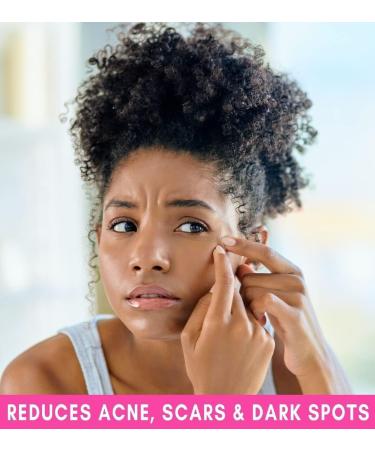 Demure Sulphur & Salicylic Acid Exfoliating Soap Bar | Reduces Acne, Soothes, Moisturizes, Softens Skin | Anti-Blemish Formula - Buy Online on GoSupps.com