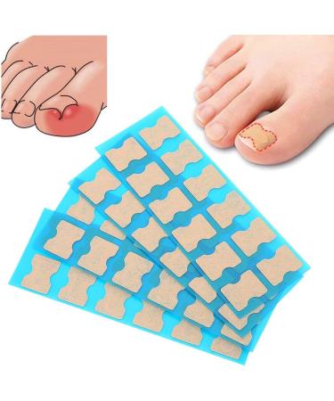 Ingrown Toenail Patch Pedicure Sticker Ingrown Toenail Correction Patch Foot Care Pedicure Sticker Toenail Treatment Tool (48 pieces) - Buy Online on GoSupps.com