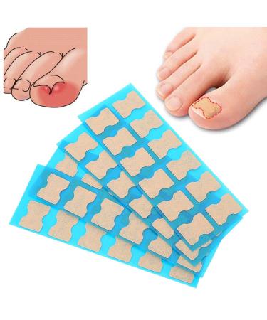 Ingrown Toenail Correction Foot Care Pedicure Sticker Corrector Ingrown Patch Relief Toe Patch Treatment Tool60pcs (48 Pieces)