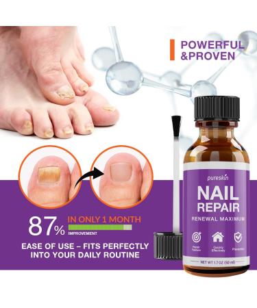 Pureskin Nail Renewal Solution - Maximum Strength Nail Care for Healthy Finger & Toenail, Athlete's Foot, Ringworm - 1.7 oz - Buy Online on GoSupps.com