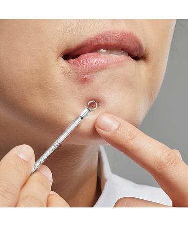 Stainless Steel Blackhead Remover & Acne Extraction Tool for Nose & Face - Jawflew Pimple Popper and Comedone Extractor - Buy Online on GoSupps.com