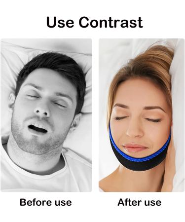 4 Pcs Anti Snoring Devices Snoring Aids for Men Chin Strap Mouth Breathing Snoring Chin Strap Anti Snoring Anti Snore Devices Anti Snoring Chin Strap Sleep Apnea Devices for Men Women(Black Blue) - Buy Online on GoSupps.com