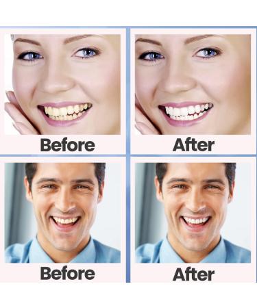 Vueix Teeth Whitening Strips 5D - 14 Sets for Smoking/Coffee Stain Removal | Home Tooth Whitening Kit - 28pcs White Strips - Buy Online on GoSupps.com
