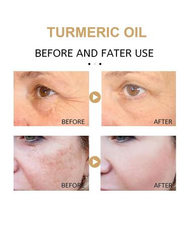 2023 Turmeric Dark Spot Serum Oil - Brighten Skin & Correct Dark Spots (colorless 2P) - Buy Online on GoSupps.com