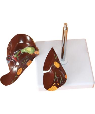 Liver Anatomy Model Human Liver Disease Model Liver Fat/Cirrhosis/Pathological Hepatobiliary Disease Model Medical Education and Training Auxiliary Human Organ Anatomical Model - Buy Online on GoSupps.com