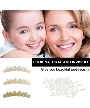 Buy Provisional Dental Prosthesis - 2 Pieces Cosmetic Veneers for Perfect Smile | International Shipping - Buy Online on GoSupps.com
