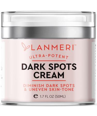 Lanmeri Dark Spot Remover for Face and Body, Dark Spot Corrector Fade Cream, Age Spot, Brown Spot, Sun Spot & Freckle Remover for Face, Hands and Other Body Areas, for Both Women and Men, for All Skin Types