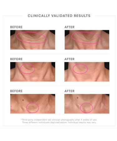 Juice Beauty STEM CELLULAR Lifting Neck Cream with Squalane 1.7 fl oz | Tightens, Smooths, Defies Gravity - Buy Online on GoSupps.com