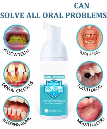 Mouthwash Foam Set - Teeth Whitening and Calculus Removal | Eliminate Bad Breath (2PCS) - Buy Online on GoSupps.com