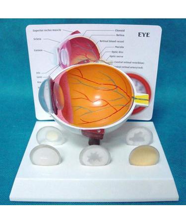 Mod le Anatomies Malade Human Eye Pin Yey Blessure Eye Corn e Cataparakt Eye Mod le Education pour l' cole