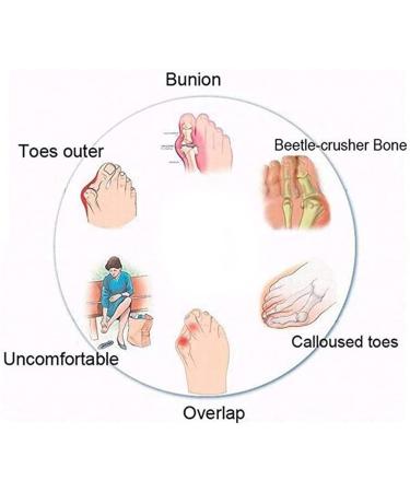 Bunion Sandals for Women - Comfortable Foot Correction Wedges Summer Casual Walking 7.5 Black - Buy Online on GoSupps.com