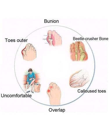 Bunion Corrector Sandals for Women - Pain Relief & Hallux Valgus Correction - Size 7, Black - Buy Online on GoSupps.com