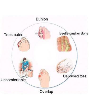 Buy Big Toe Bone Corrector Sandals for Women | Comfortable Bunion Relief with Soft Footbed | Hallux Valgus Pain Relief - Dark Blue Size 6 - Buy Online on GoSupps.com