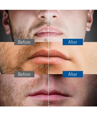 Jodial Safety Razor for Men & Women - Rose Gold Double Edge Razor with 10 Platinum Blades | International Shipping Available - Buy Online on GoSupps.com