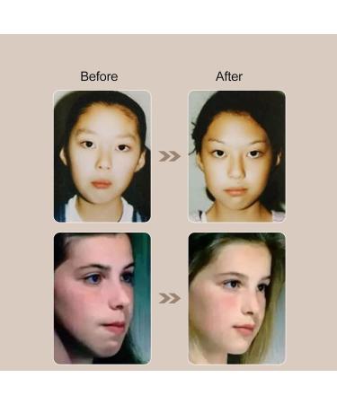 Buy Mouth Trainer Massager & Lip Muscle Trainer for Breathing - Perfect for Kids | International Shipping - Buy Online on GoSupps.com