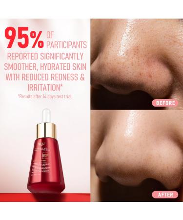 TRUU 5% Mandelic Acid Serum for Oily Skin | Targets Enlarged Pores Exfoliates & Rebalances Oil | Radiant Complexion | 1.1 Oz - International Shipping Available - Buy Online on GoSupps.com