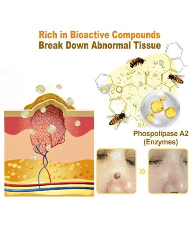 Awzlove Bee Venom Treatment Cream 2024 | Hydrating & Moisturizing Repair Cream for Men & Women - 1 Fl Oz - Buy Online on GoSupps.com