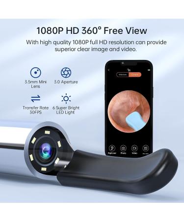 Wireless HD 1080P Ear Wax Removal Tool Camera | Waterproof Ear Cleaner Endoscope with 6 LED Lights | Compatible with iPhone, iPad & Android | for Kids, Adults & Pets | Antique Black - Buy Online on GoSupps.com
