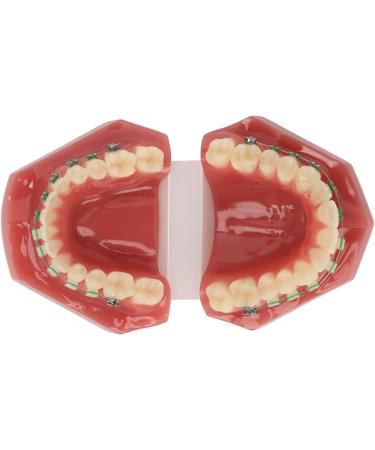 Professional Portable Orthodontic Bracket Model - Ideal for Dentist Learning & Training | International Shipping Available - Buy Online on GoSupps.com
