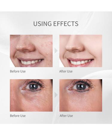 COSBEAUTY Skin Scrubber & Blackhead Remover | 28K Facial Cleansing Tool | Acne Extractor & Pore Cleaner | 5 Modes | Waterproof & Wireless Charging | Black - Buy Online on GoSupps.com