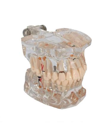 Buy DYTAH Transparent Teeth Model - Removable Pathological Tooth for Dental Training & Examination | International Shipping - Buy Online on GoSupps.com