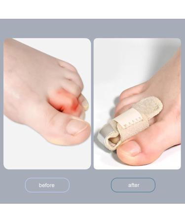 Hammer Toe Corrector Splint for Adults - Left Foot - Toe Straightener and Brace for Men and Women - Buy Online on GoSupps.com