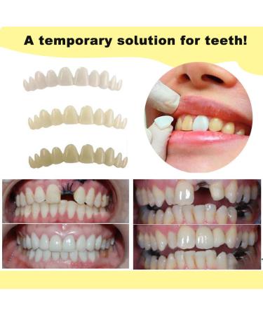 Dental Repair Kit - Quick Fix for Lost & Broken Teeth | Natural-Looking Smile Restoration - Buy Online on GoSupps.com