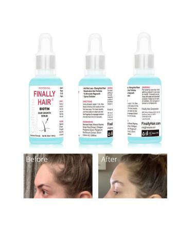 Women's Hair Loss Treatment Serum with Biotin, Collagen, and Caffeine - Promotes Hair Growth and Supports Regrowth - Buy Online on GoSupps.com