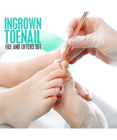 Fandamei Corner Lifter & Nail File Set - Stainless Steel Toenail Tools for Professional Manicure & Pedicure - Double-Sided Foot Care in Rose Gold - Buy Online on GoSupps.com