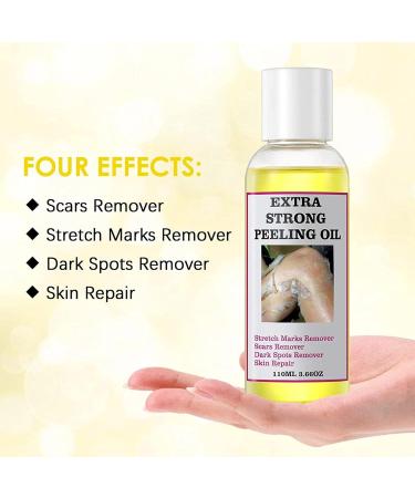 Eoixuqba 110ml Peeling Oil Extra Strength Whitening Yellow Peeling Oil Yellow Peeling Oil For Dark Skin Super Strength Yellow Peeling Oil Dark Skin For BodyFor Body Lightening Bleaching - Buy Online on GoSupps.com