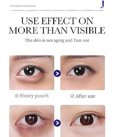  TiLLOw Lumineyez Collagen Anti-Wrinkle Eye Cream Under Eye Cream for Dark Circles & Puffiness Anti-Aging Eye Cream for All Skin Types (3 pcs) - Buy Online on GoSupps.com