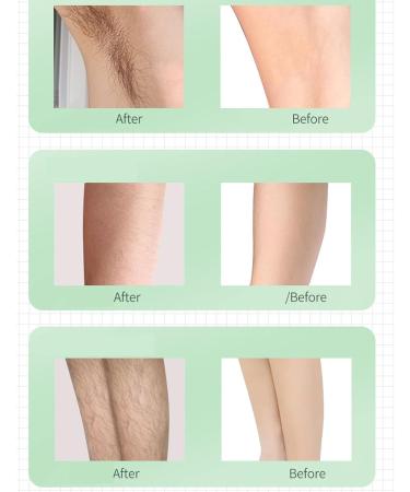 Pain-Free Hair Remover Device with Green LCD 5 Modes Ergonomic Handle - Safe Home Use (EU 100 240V) - Buy Online on GoSupps.com