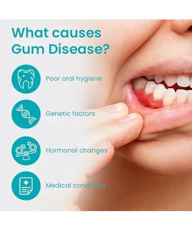 2024 Lovilds Gum Therapy Gel - Neslemy Gum Shield & Tooth Gel (1 & 2 pcs) | Best International Shipping - Buy Online on GoSupps.com