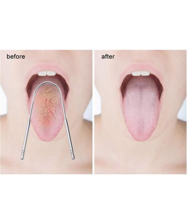 Stainless Steel Tongue Scraper 2 Pack - Bad Breath Reducing Metal Cleaners in Various Shapes - Buy Online on GoSupps.com