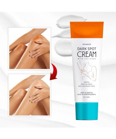 Natural Vine Dark Spot Cream - Instant Results, 60ML - Moisturizes Armpit, Neck, Knees, Private Parts - Orange - Buy Online on GoSupps.com