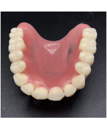 Vinbcorw Dental Model - Maxilla Mini 4 Implant Screws for Mobile Prosthesis Repairs | Removable Pink Design - Buy Online on GoSupps.com