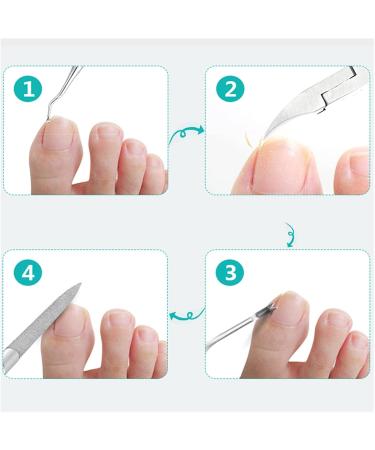 SJLS Black Toenail Ingrown Nail Art Cuticle Nipper Clipper Edge Cutter Manicure Scissor Plier Tool Pedicure Dead Skin Remover (Color : As Show) - Buy Online on GoSupps.com