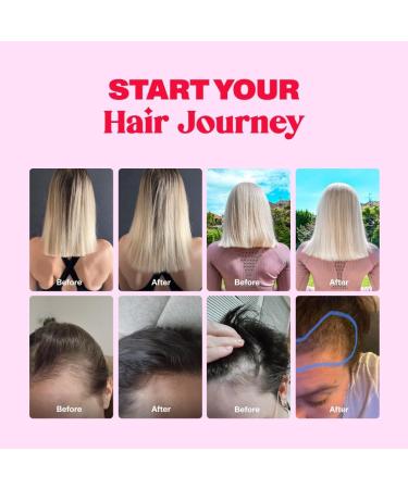 Hair Gummy Prenatal Vitamins for Women Pregnancy with Vitamin B6 - Pre Natal Multivitamin for Women & Folic Acid - 60 Prenatal Hair Gummies with Folic Acid (1Pack) 60 Count (Pack of 1) - Buy Online on GoSupps.com