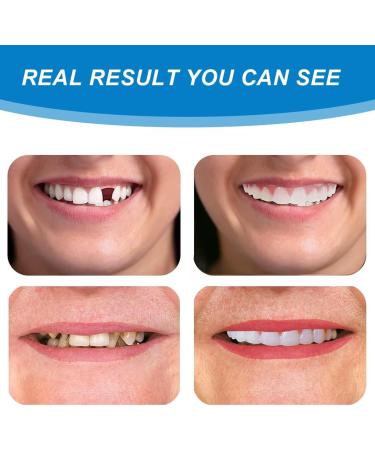 Buy WTTFC Plug-In Veneers - 2 Pairs of Temporary Fake Teeth for Men & Women - Smile Prostheses for a Perfect Look - Buy Online on GoSupps.com