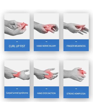 Hand Stroke Hemiplegia Rehabilitation Training Equipment Finger Orthoses Rehab Gloves Blue One Size - Buy Online on GoSupps.com