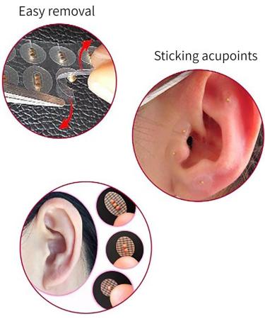 Buy Ear-Seed Acupuncture Stickers | Multi-State Acupressure Set for Facial Reflex Zone Massage | International Shipping - Buy Online on GoSupps.com