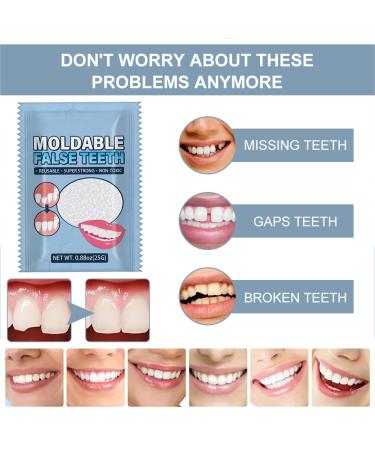 Provisional Dentures & Temporary Tooth Repair Set - Vampire Fake Dentures | International Shipping - Buy Online on GoSupps.com