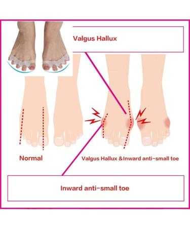 CAZARU FXJ Toe Separator Socks for Men - Hammer Toe Corrector, Gel Separators, Yoga Claw Splint Protectors - 1 Pair - Buy Online on GoSupps.com