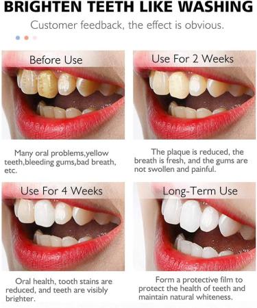 Symeas Teeth Whitening Toothpaste Ultra-fine Foam Deep Cleaning Gums Stain Remover Foam Toothpaste for Electric Toothbrush - Buy Online on GoSupps.com