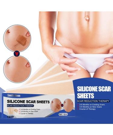 Universal Scar Repair Sticker | Soft Skin Patch | Lighten Pigmentation | Surgical Scar Repair | 4Pcs (Style A/S) - Buy Online on GoSupps.com