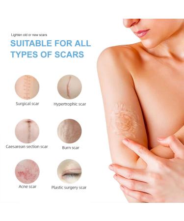 Silicone Scar Sheets 4 Pack - 5.7x1.57 | Professional C-Section Scar Removal Tape - Buy Online on GoSupps.com