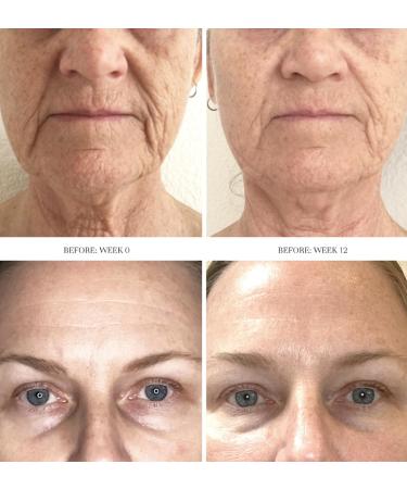 City Beauty Dermal Reset Exfoliating Concentrate - AHA Lactic Acid Facial Exfoliant for Wrinkles & Pores - Anti-Aging Cruelty-Free Skin Care Ship Internationally - Buy Online on GoSupps.com