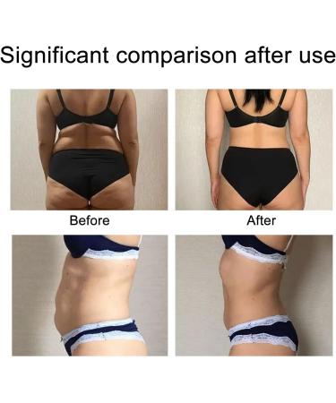 Abdomen Lift Tapes for Firming and Slimming | Cellulite and Sagging Skin Treatment | Tummy Slimming Wrap for Definition - Buy Online on GoSupps.com