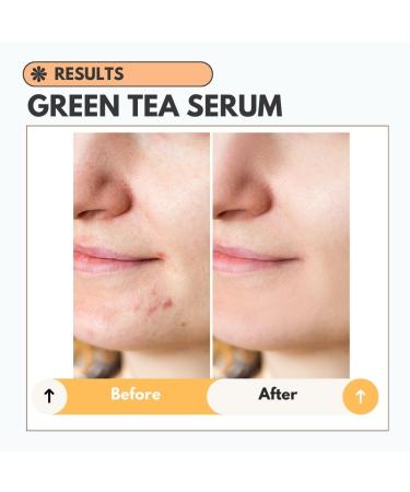 Clarifying Green Tea Hyaluronic Acid Serum | Niacinamide | Skin Repairing Face Serum for Red Light Therapy - International Shipping - Buy Online on GoSupps.com